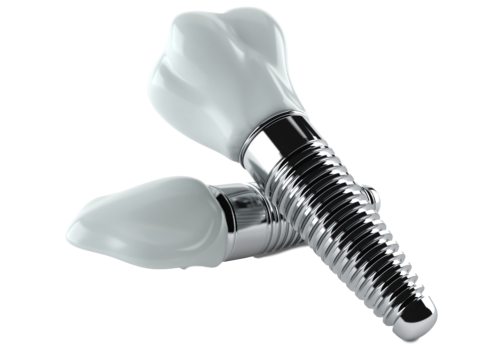 Немецкие импланты чаще всего относятся к премиум-классу Немецкие импланты чаще всего относятся к премиум-классу