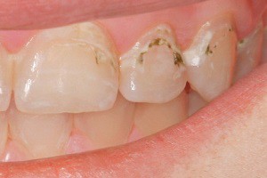 Стоматологические заболевания, вызывающие патологию