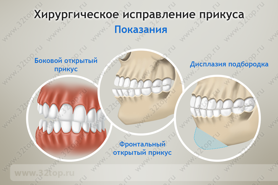 Правильный прикус у человека фото схема как определить