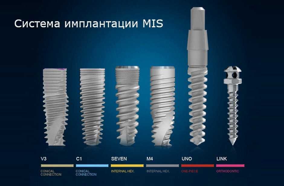 Импланты MIS 7 Seven Томск Новосибирский Удаление кисты зуба Томск Айвазовского