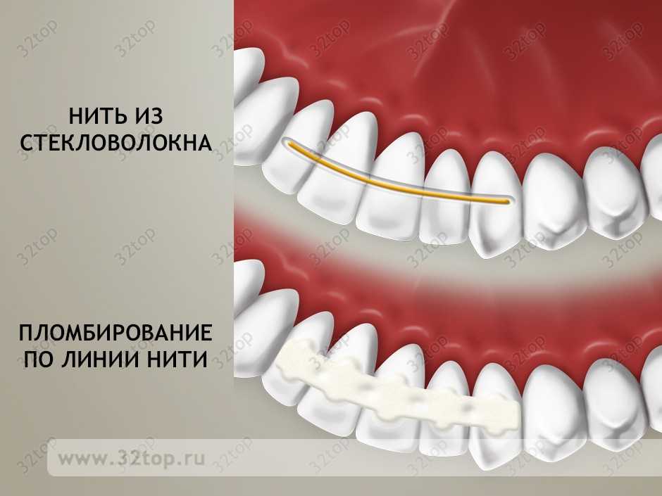 Ретейнеры Томск Маяковского Лечение зубов под наркозом Томск Ивановского
